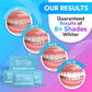 Professional Teeth Cleaning & Whitening Strips (14 Treatments)