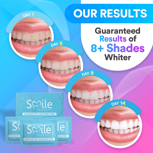 Teeth Cleaning & Whitening Strips (14 Treatments)