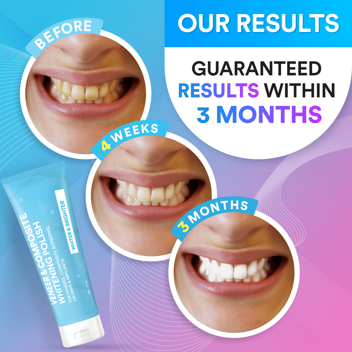 Veneer & Composite Whitening Polish Toothpaste